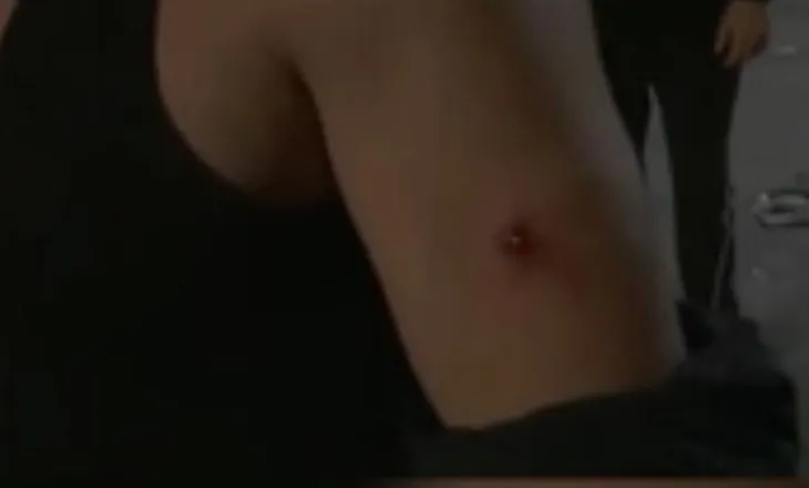 Na kanë bërë copa-copa’/ Policia godet me plumb gome në krah të riun protestues