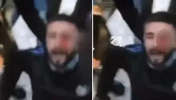 Pamje të rënda/ Dhuna policore kalon çdo limit, qëllon me plumb gome në sy të riun protestues