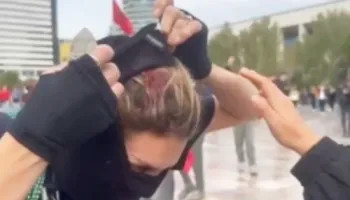 Pamje të rënda/ Studentja çahet në kokë