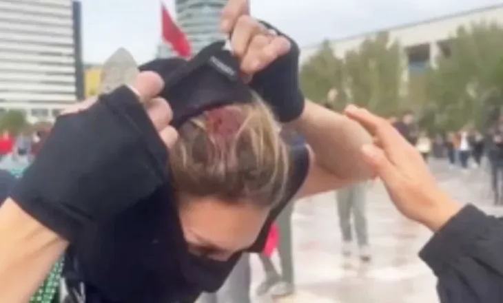 Pamje të rënda/ Studentja çahet në kokë