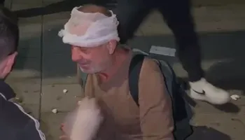 Pamje të rënda te Kryeministria/ Qytetari qëllohet me plumb gome në kokë nga policia