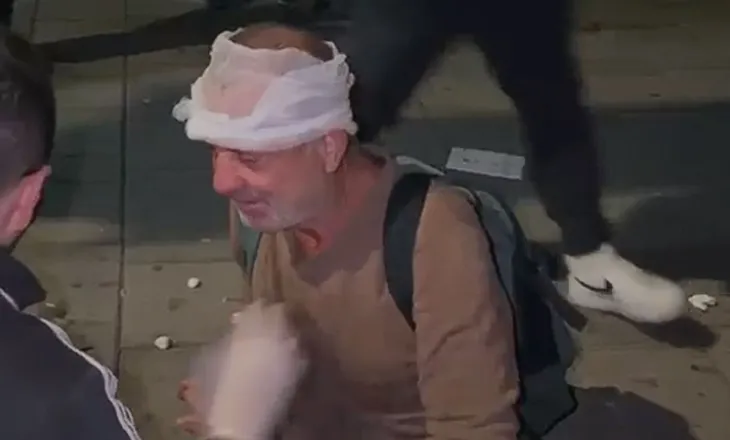 Pamje të rënda te Kryeministria/ Qytetari qëllohet me plumb gome në kokë nga policia