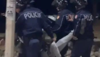 Pamjet e rënda të 19-vjeçarit me këmbën e thyer, Policia: Pezullohen nga detyra 4 efektivë dhe shefi i komisariatit nr.1