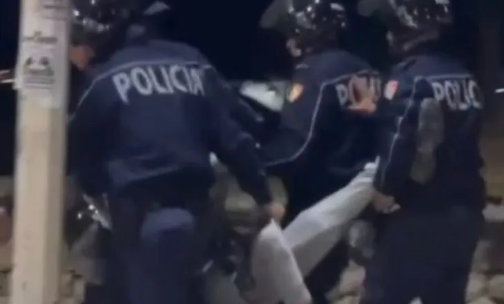 Pamjet e rënda të 19-vjeçarit me këmbën e thyer, Policia: Pezullohen nga detyra 4 efektivë dhe shefi i komisariatit nr.1