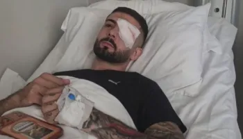 “Plumbin e gomës e kam ende në sy”, Erjon Vishkulli rrëfen plagosjen në protestë: Eca dy metra dhe rashë në tokë