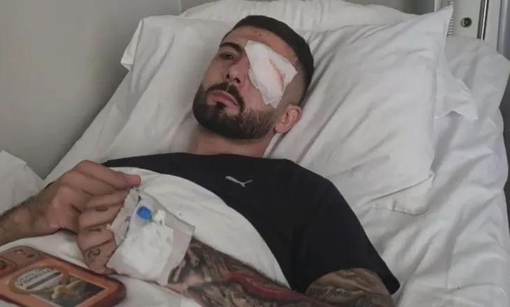 “Plumbin e gomës e kam ende në sy”, Erjon Vishkulli rrëfen plagosjen në protestë: Eca dy metra dhe rashë në tokë