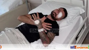 “Po përballem edhe me një sfidë tjetër të rëndësishme”, dëmtoi syrin në protestë, reagon sërish Erjon Vishkulli