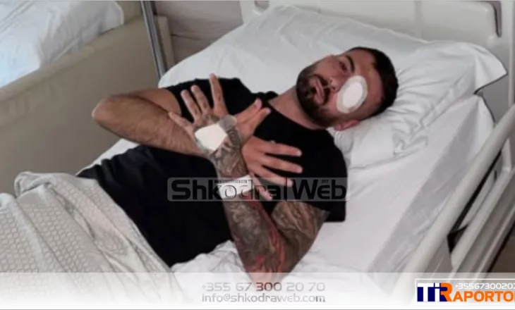 “Po përballem edhe me një sfidë tjetër të rëndësishme”, dëmtoi syrin në protestë, reagon sërish Erjon Vishkulli