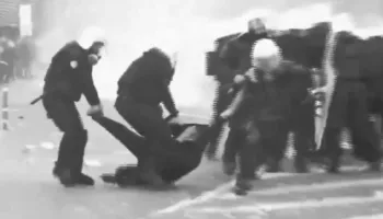 Policët i thyen këmbën në protestë, Ledion Balla tregon ngjarjen. Nëna tregon dëmtimet e rënda