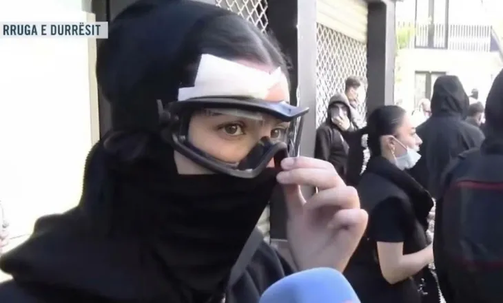 Policia e goditi me plumb gome në kokë/ Vajza e lënduar: Do isha dëmtuar rëndë në sy