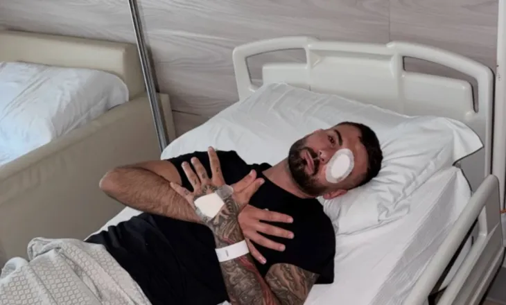 Policia e qëlloi me plumb gome në sy/ Reagon Erjon Vishkulli: Faleminderit për mbështetjen , u shtofshin shqiptarët e mirë!