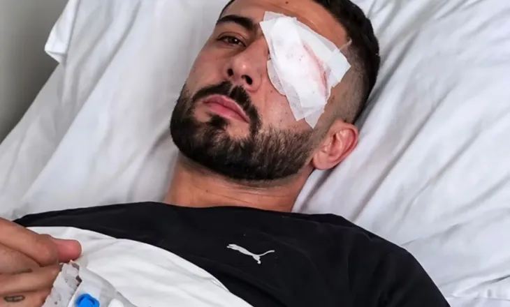 Policia e qëlloi me plumb në sy, i riu Erion Vishkulli mbërrin në Romë, futet në operacion sërish