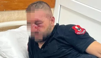 Policia e Shtetit: 14 efektivë të plagosur nga dhuna në protestë, shoqërohen 35 persona. Përgjegjësit do të përballen me ligjin