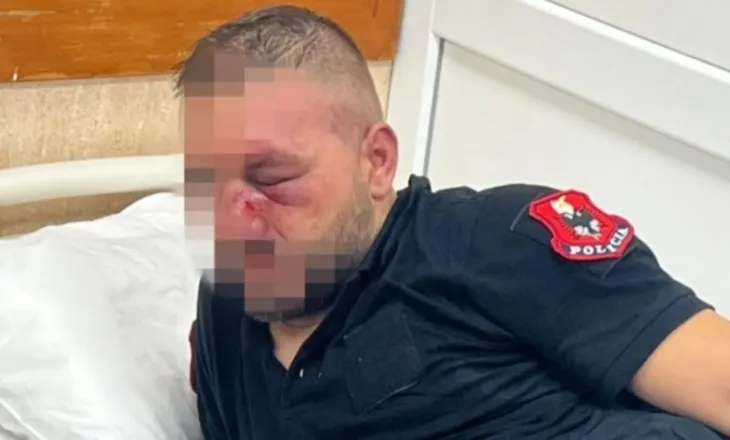 Policia e Shtetit: 14 efektivë të plagosur nga dhuna në protestë, shoqërohen 35 persona. Përgjegjësit do të përballen me ligjin