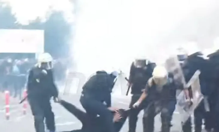 Policia: Po hetojmë videon ku 19 vjeçari del me këmbë të thyer, policët pezullohen…