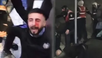 Policia pranon dhunën ndaj protestuesve, hetime për plagosjen në sy të 28-vjeçarit