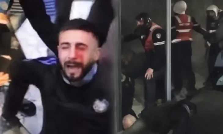 Policia pranon dhunën ndaj protestuesve, hetime për plagosjen në sy të 28-vjeçarit