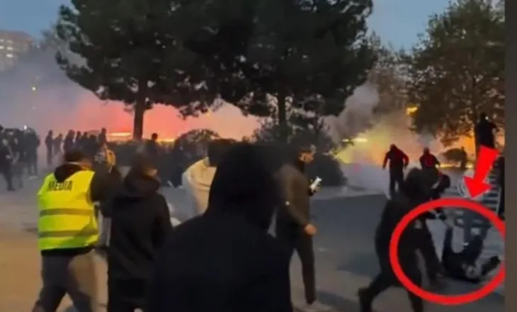 Protesta e 24 tetorit, dalin pamjet kur Erjon Vishkulli pëson dëmtimin në sy