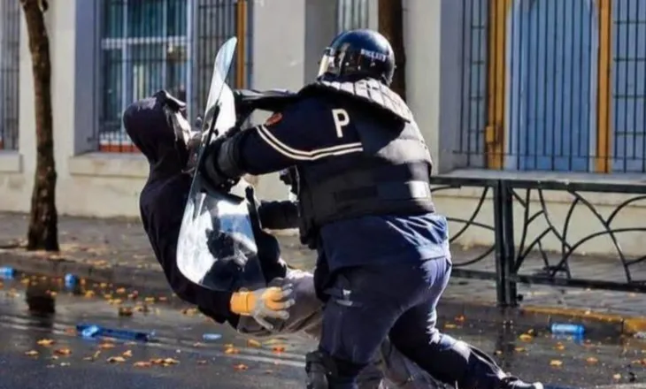 Protesta e studentëve/ ‘Shëndetësia’ jep lajmin e mirë: 21-vjeçari që u godit nga polici s’ka rrezik për paralizë