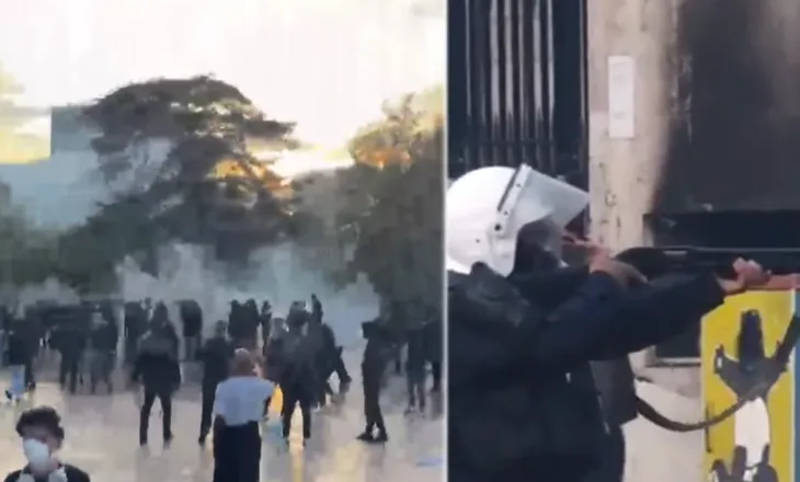 Protesta në Tiranë, një person dërgohet pa ndjenja te Trauma me dëmtime në sy, dyshohet për plumb gome