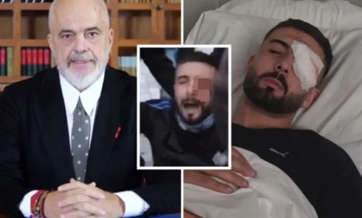 Reagon Kryeministri për rastin e Erjon Vishkullit