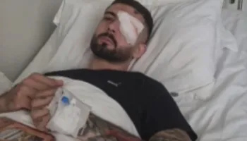 Shqipëria është e jona’/ Vishkulli rrëfen momentin e plagosjes: Isha 30 metra larg policëve, po rrija pa asnjë reagim