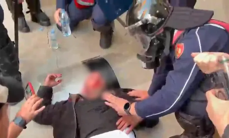 “Shyqyr që dole gjallë!”/ Momenti kur Policia shpëton qytetarin e dhunuar nga protestuesit e maskuar
