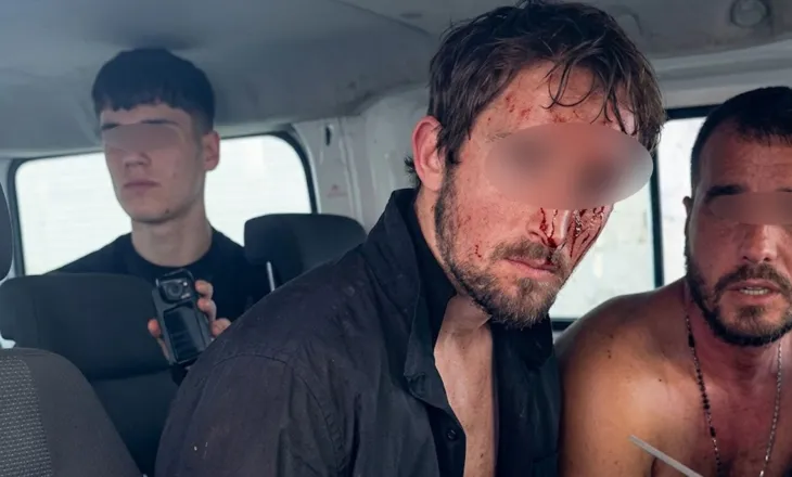 Studentët e gjakosur në furgonin e Policisë/ Deputeti: Do të mbani përgjegjësi