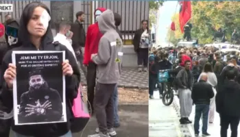 Të rinjtë fashojnë sytë në shenjë solidariteti me Erjon Vishkullin që u qëllua me plumb në sy