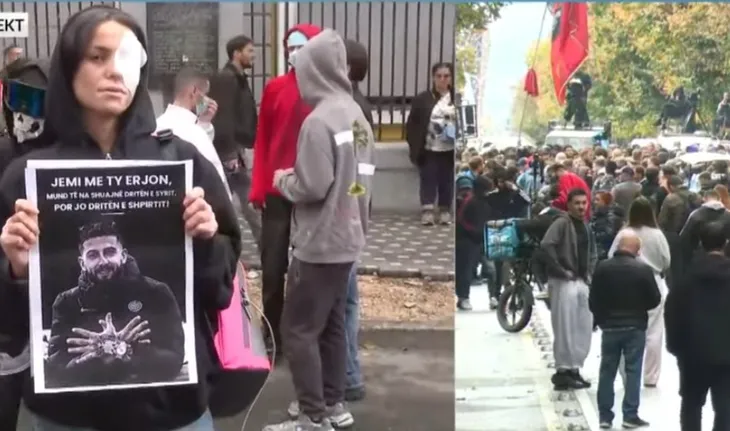 Të rinjtë fashojnë sytë në shenjë solidariteti me Erjon Vishkullin që u qëllua me plumb në sy