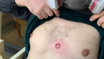 Terror/ Policia nuk ndal dhunën/ Goditet me plumb gome dhe Altin Goxhaj