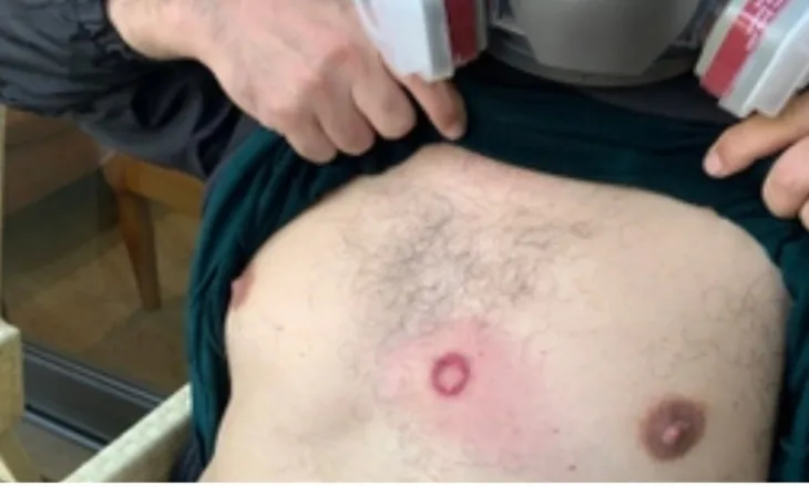 Terror/ Policia nuk ndal dhunën/ Goditet me plumb gome dhe Altin Goxhaj