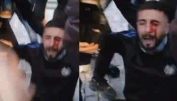 U godit me plumb gome në sy/ Ministria e Shëndetësisë zbulon si është gjendja shëndetësore e të riut