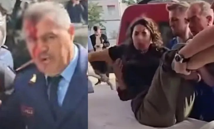 U godit në kokë gjatë protestës, efektivi i policisë përfundon operacionin me sukses