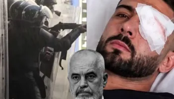 U godit nga policia me plumb gome në sy/ Demokratët Evropianë ‘shuplakë’ Ramës: Promovim politik në kurriz të Erjonit
