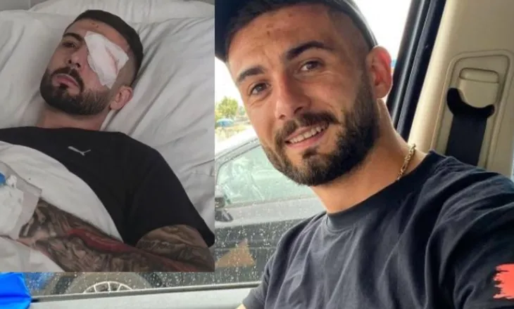 U plagos në sy gjatë protestës, Erjon Vishkulli kalon me sukses operaconin në Itali