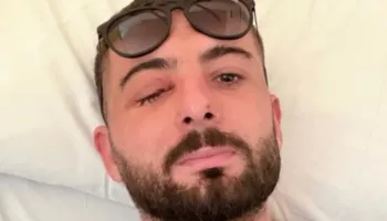 U plagos në sy gjatë protestës, Erjon Vishkulli poston foton pas operacionit në Itali