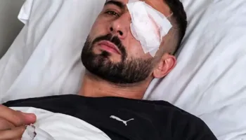 U plagos në sy, Prokuroria nis hetim për rastin e Erjonit. Në fokus edhe përdorimi i dhunës nga Policia gjatë tubimeve