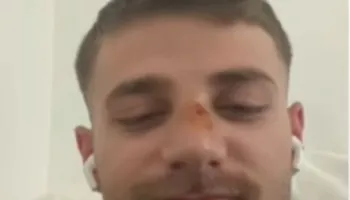 U tërhoq zvarrë nga policia me këmbën e thyer/ Protestuesi rrëfen ngjarjen: Më dhunuan në furgon…