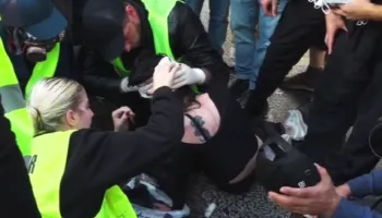 Vajza shtrihet në mes të rrugës dhe ka plagë në kokë, mbytet nga gazi lotsjellës