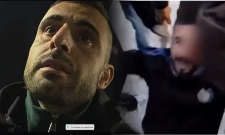 Vëllai i 28-vjeçarit që u plagos në sy: Çdo shpenzim është kryer nga shteti, gjendja e Erjonit është e stabilizuar