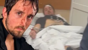 VIDEO/ U përball i vetëm me 6 policë, Klevi Metaj tregon gjendjen e tij në spital…