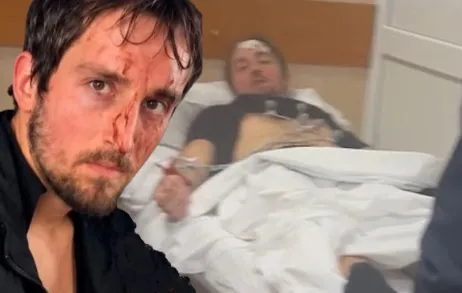 VIDEO/ U përball i vetëm me 6 policë, Klevi Metaj tregon gjendjen e tij në spital…