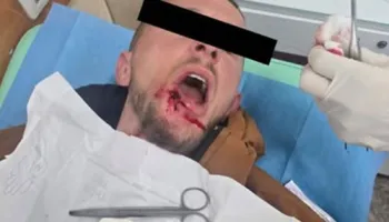 Zvicra reagon për protestat në Shqipëri: Ndalni përshkallëzimin e dhunës