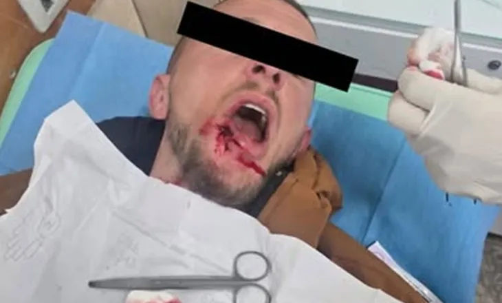 Zvicra reagon për protestat në Shqipëri: Ndalni përshkallëzimin e dhunës